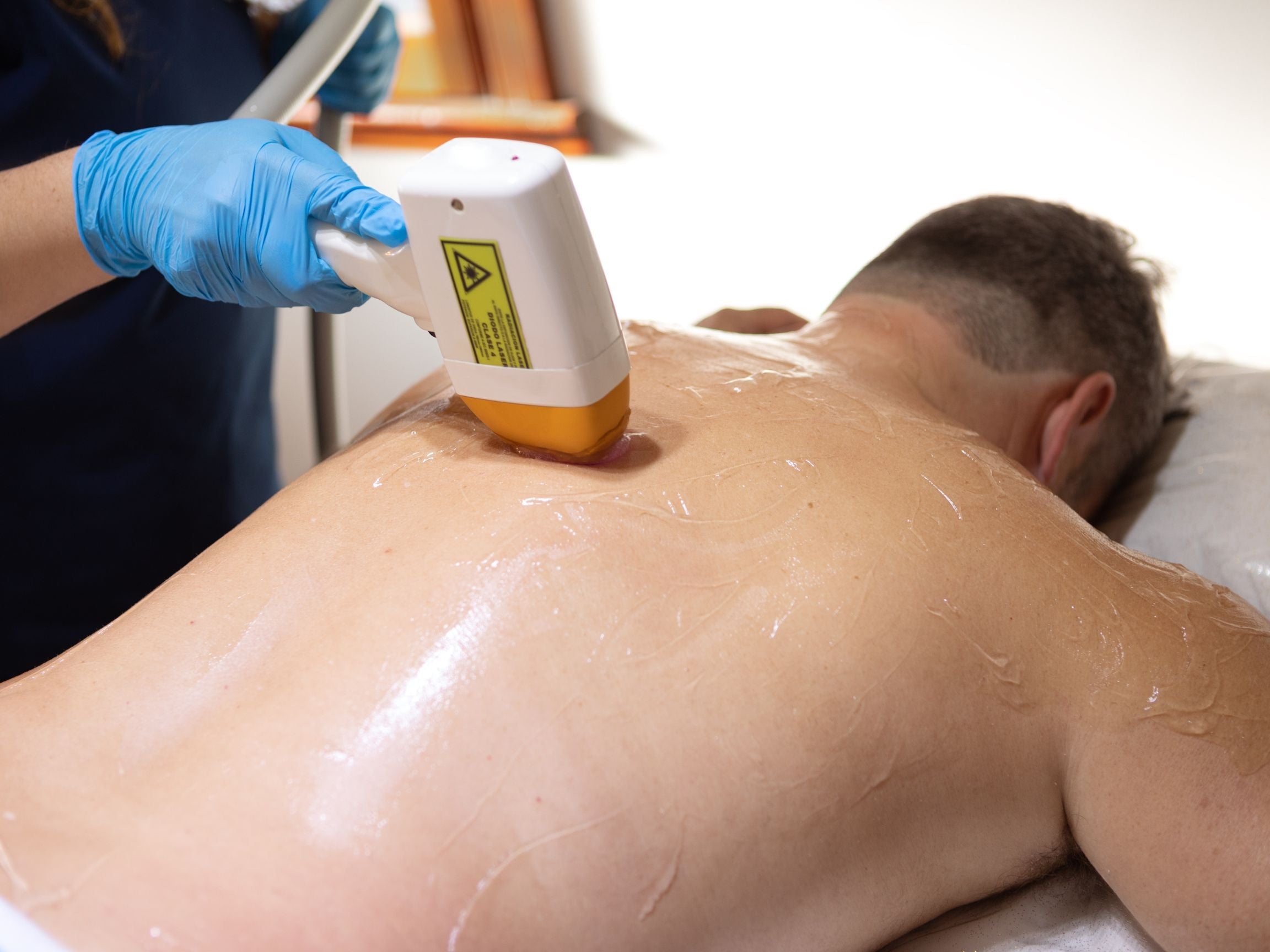 The Complete Guide to Laser Hair Removal for Men