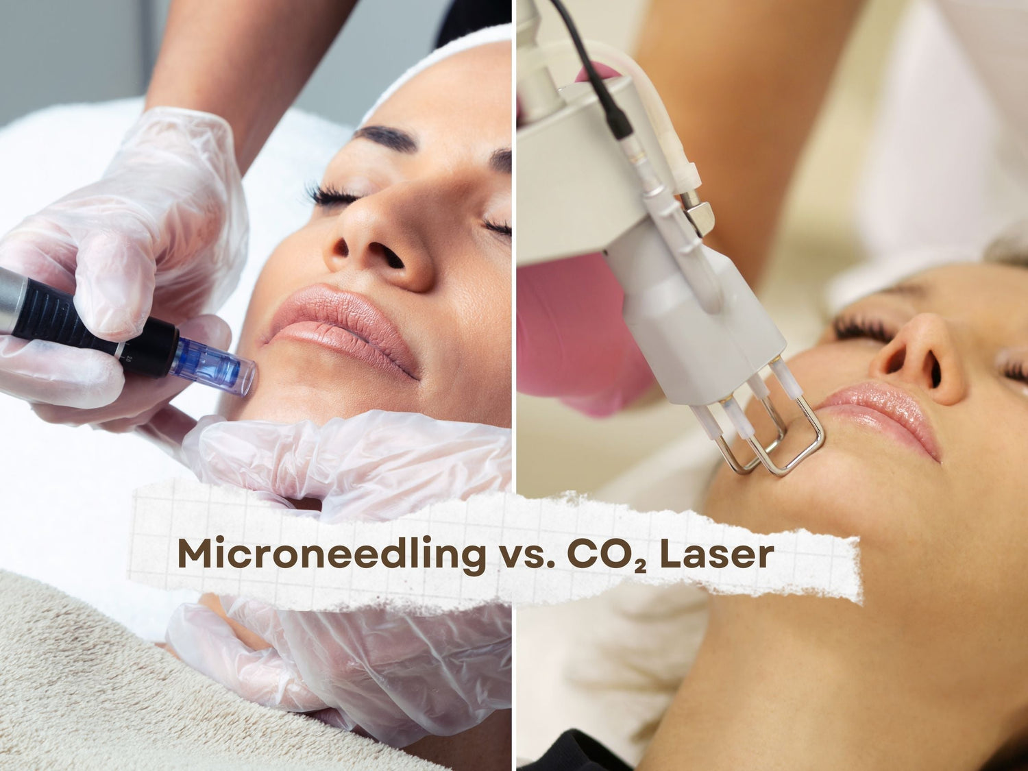 Microneedling vs. CO₂ Laser — Which Skin Treatment Is Right for You?