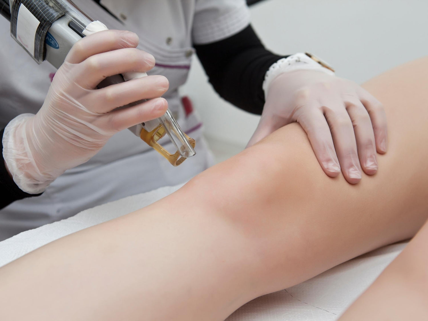 PicoSure Laser Treatments in Mississauga: Clearer Skin, Fewer Sessions, Real Results