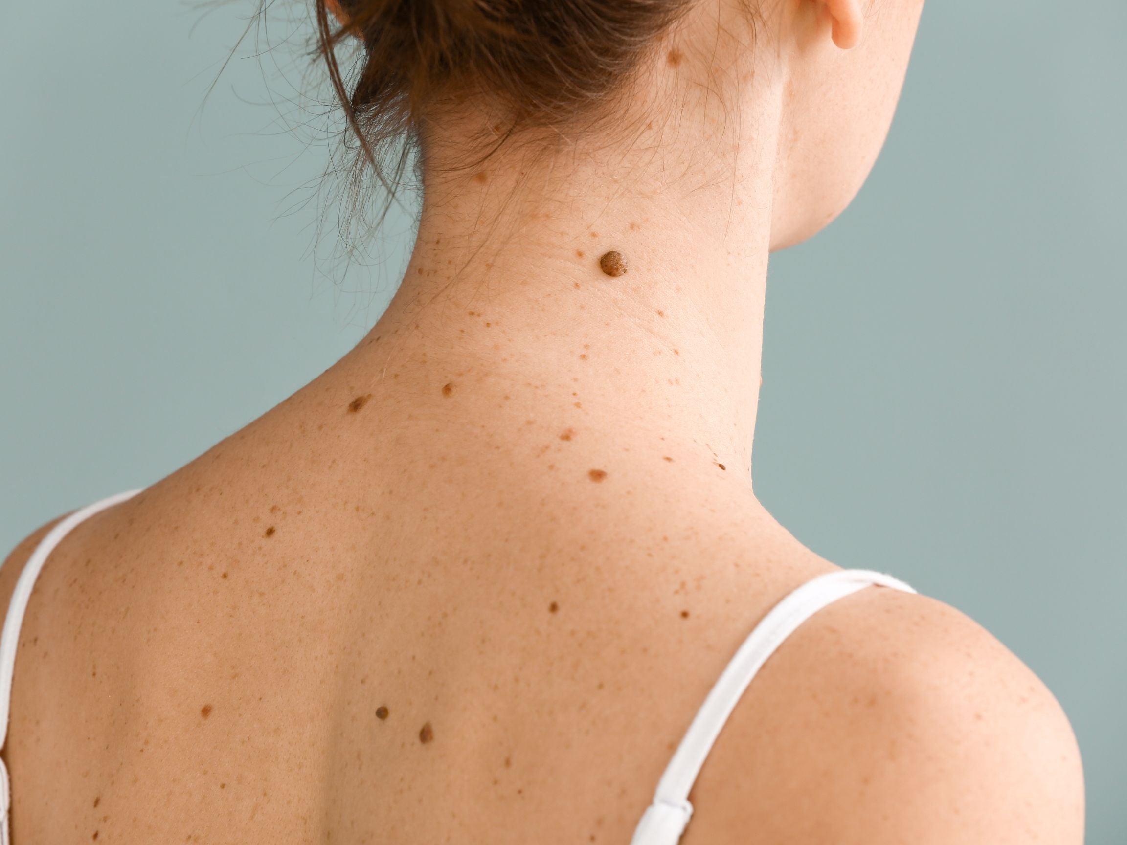 Safe & Effective Options for Lump and Bump Removal