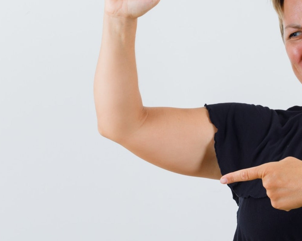 Crepey Arms with Radiesse®