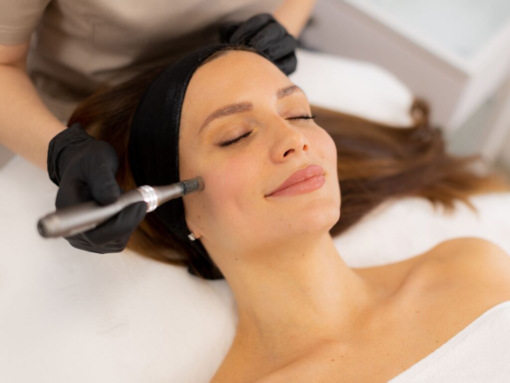 Microneedling Recovery Process: What No One Will Tell You