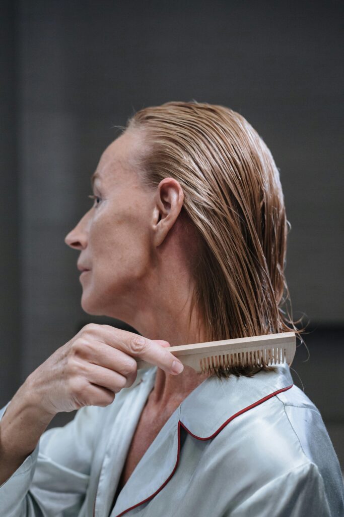 hair loss -women's health clinic - SOL SKIN Dermatology Treatments